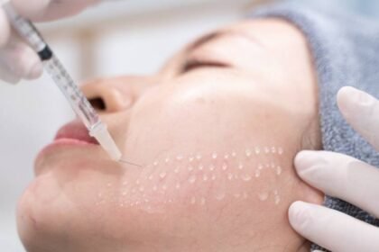 What is Mesotherapy for Face?